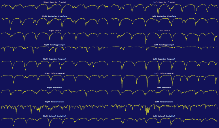 icEEG